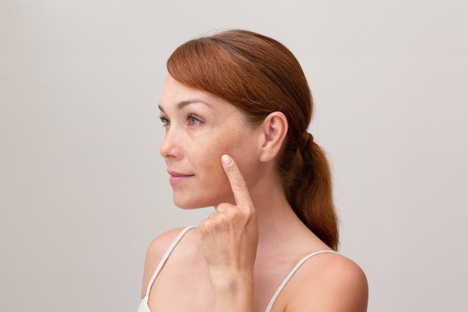 Red-haired woman in a white top pointing at freckles and pigmentation on her bare cheek, seen in profile.