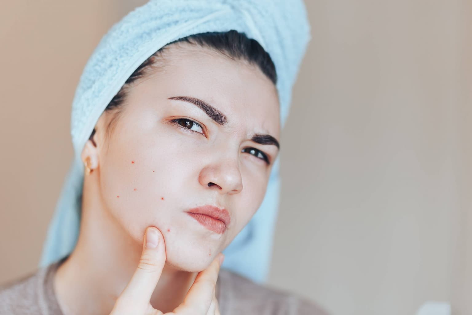 Woman with a light blue towel wrapped around her hair frowning as she touches the red breakout spots on her cheek and chin.