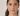 Dark Spots on Sensitive Skin? Try Bioderma Pigmentbio