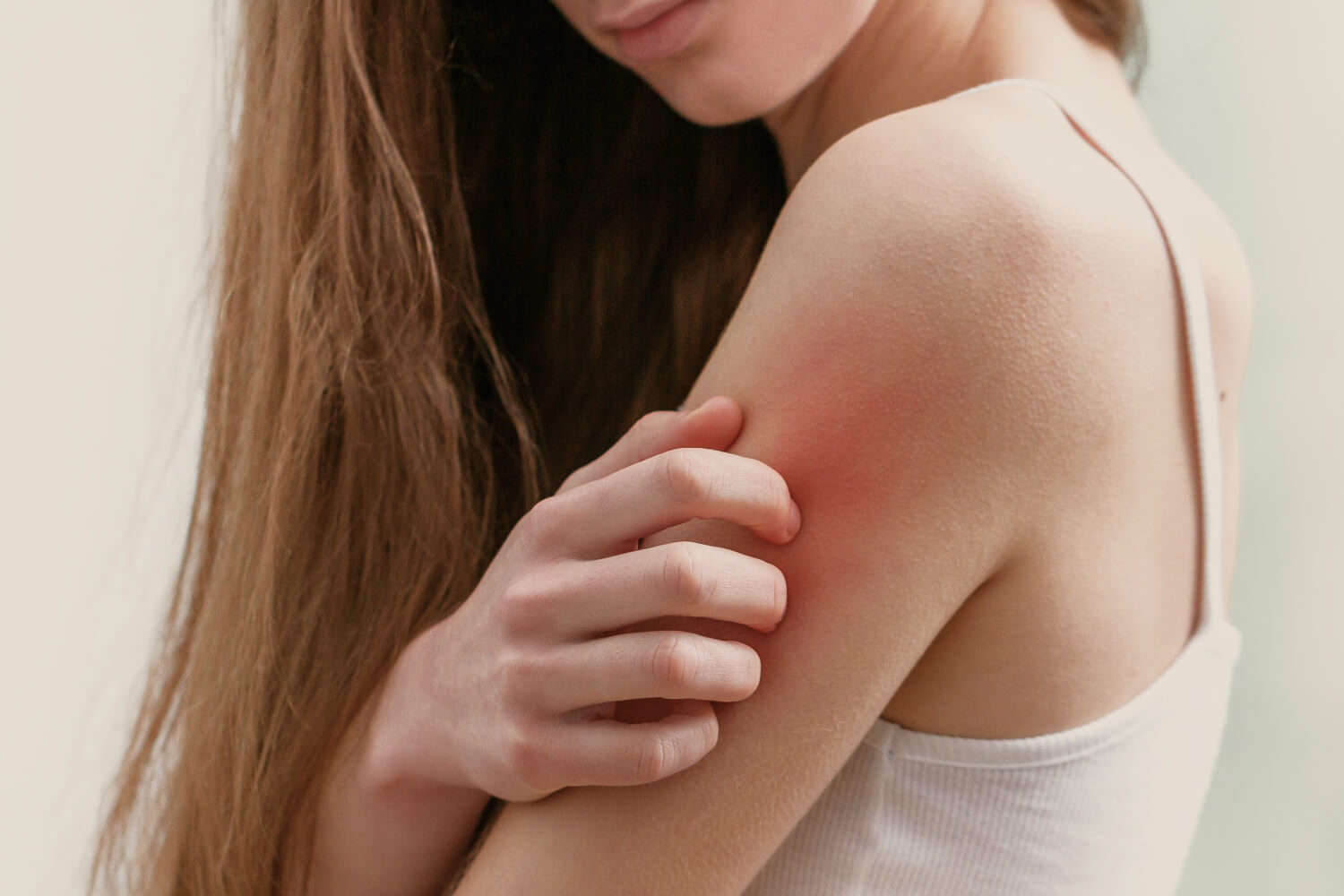 Best Creams for Itchy Skin Relief