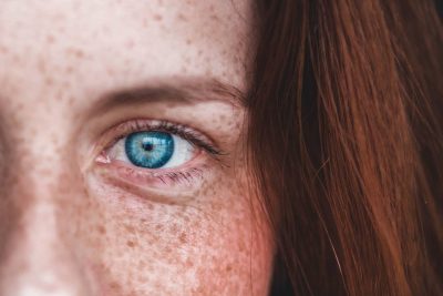 Skincare To Prevent & Reduce Hyperpigmentation During Pregnancy